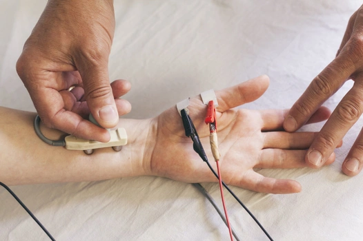 Nerve Conduction Velocity (NCV)